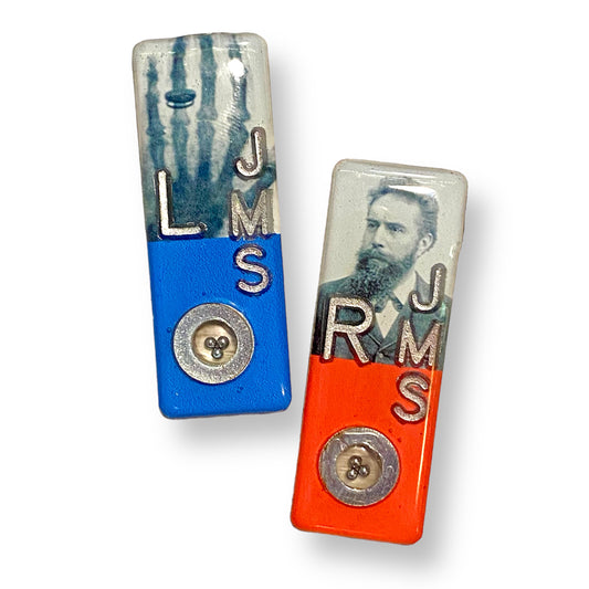 Xray Markers Wilhelm Roentgen with BB’s