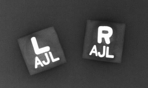 Autism Puzzle Xray Markers Customized with Initials